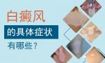 北京治疗白癜风的医院讲解：白癜风发生会表现出什么病症